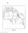 Fig. 12 - Devices systems and methods for assessment of vessels