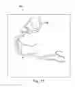 Fig. 15 - Devices systems and methods for assessment of vessels
