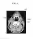 Fig. 12 - METHOD AND APPARATUS FOR PERFORMING COMPUTED TOMOGRAPHY (CT) IMAGING BY INJECTING CONTRAST MEDIUM