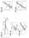 Fig. 09 - Systems for locking a cinch loop in tissue repair