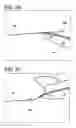 Fig. 16 - Systems for locking a cinch loop in tissue repair