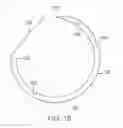 Fig. 22 - Apparatus and method for minimally invasive suturing