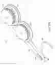 Fig. 32 - Apparatus and method for minimally invasive suturing