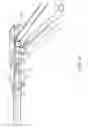 Fig. 80 - Apparatus and method for minimally invasive suturing