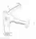 Fig. 02 - Bone staple inserter