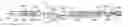 Fig. 01 - Implantable medical device detachment system with split tube and cylindrical coupling