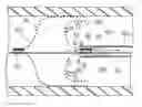 Fig. 01 - Suction catheter, suction system, and treatment method