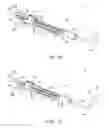 Fig. 02 - DILATION INSTRUMENT WITH GUIDE CATHETER TYPE SENSOR