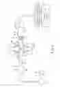Fig. 06 - Joint surgical system