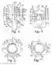 Fig. 03 - Pivotal bone anchor assembly with independent lock via insert compressing tool
