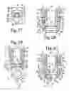 Fig. 09 - Pivotal bone anchor assembly with independent lock via insert compressing tool