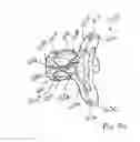 Fig. 35 - Intervertebral implant devices and methods for insertion thereof