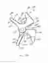 Fig. 40 - Intervertebral implant devices and methods for insertion thereof