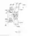 Fig. 45 - Intervertebral implant devices and methods for insertion thereof