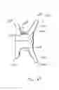 Fig. 46 - Intervertebral implant devices and methods for insertion thereof