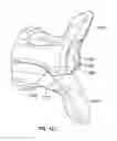 Fig. 97 - Intervertebral implant devices and methods for insertion thereof