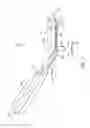 Fig. 02 - Zygomatic elevator device and methods