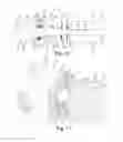 Fig. 05 - Headless compression screw driver system