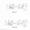 Fig. 08 - Headless compression screw driver system