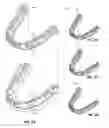 Fig. 06 - Closed loop adaptive orthodontic treatment methods and apparatuses