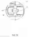 Fig. 07 - Hybrid prosthesis and delivery system