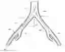 Fig. 01 - INTRODUCER FOR A SIDE BRANCH DEVICE