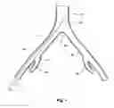 Fig. 02 - INTRODUCER FOR A SIDE BRANCH DEVICE