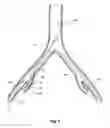 Fig. 06 - INTRODUCER FOR A SIDE BRANCH DEVICE