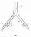 Fig. 07 - INTRODUCER FOR A SIDE BRANCH DEVICE
