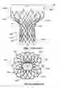 Fig. 02 - Valve prostheses having an integral centering mechanism and methods of use thereof