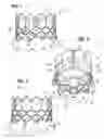 Fig. 02 - Prosthetic heart valve