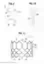 Fig. 04 - Prosthetic heart valve