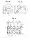 Fig. 07 - Prosthetic heart valve