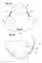 Fig. 09 - Prosthetic heart valve