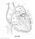 Fig. 49 - Valve docking devices, systems and methods