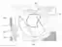 Fig. 01 - Method for performing single-stage cranioplasty reconstruction with a clear custom craniofacial implant
