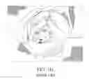 Fig. 08 - Method for performing single-stage cranioplasty reconstruction with a clear custom craniofacial implant