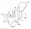 Fig. 01 - PROSTHESIS FOR A TEMPOROMANDIBULAR JOINT