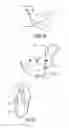 Fig. 02 - PROSTHESIS FOR A TEMPOROMANDIBULAR JOINT