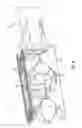 Fig. 09 - Expandable, adjustable inter-body fusion devices and methods