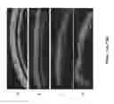 Fig. 20 - Pathways to Generate Hair Cells