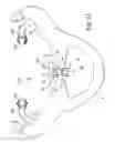 Fig. 07 - Positive-air-pressure machine conduit