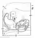 Fig. 02 - System and method for reducing pulsatile pressure
