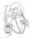 Fig. 01 - Implantable medical device for vascular deployment