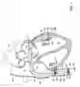 Fig. 02 - Implantable medical device for vascular deployment