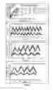 Fig. 07 - Magnetic field oscillating at several frequencies for improving efficacy and/or reducing toxicity of magnetic hyperthermia