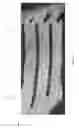 Fig. 14 - FLUID ETCHED FOAM