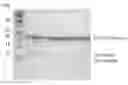 Fig. 01 - Polypeptide exhibiting affinity to antibodies forming non-native three-dimensional structure