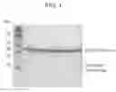 Fig. 02 - Polypeptide exhibiting affinity to antibodies forming non-native three-dimensional structure