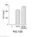 Fig. 33 - Methods of treating fibroblast growth factor 19-mediated cancers and tumors